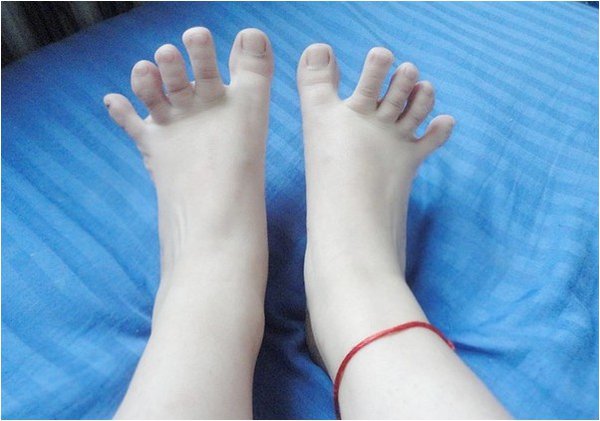 中午了，娱乐一下：你的脚趾头可以分开吗？